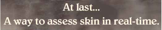 At last ... A way to asses skin in real-time.